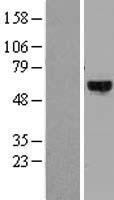 DYRK4 Protein - Western validation with an anti-DDK antibody * L: Control HEK293 lysate R: Over-expression lysate