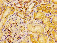 Dysferlin Antibody - Immunohistochemistry image of paraffin-embedded human kidney tissue at a dilution of 1:100