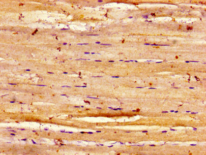 Dysferlin Antibody - Immunohistochemistry image of paraffin-embedded human skeletal muscle tissue at a dilution of 1:100