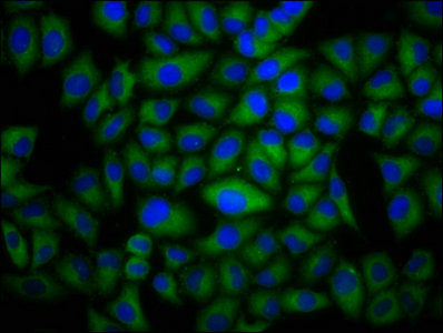 Dysferlin Antibody - Immunofluorescence staining of Hela cells with DYSF Antibody at 1:100, counter-stained with DAPI. The cells were fixed in 4% formaldehyde, permeabilized using 0.2% Triton X-100 and blocked in 10% normal Goat Serum. The cells were then incubated with the antibody overnight at 4°C. The secondary antibody was Alexa Fluor 488-congugated AffiniPure Goat Anti-Rabbit IgG(H+L).