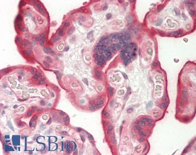 Dysferlin Antibody - Human Placenta: Formalin-Fixed, Paraffin-Embedded (FFPE).  This image was taken for the unconjugated form of this product. Other forms have not been tested.