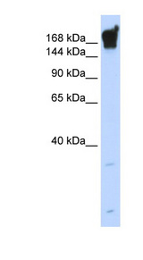 Dysferlin Antibody - DYSF / Dysferlin antibody Western blot of Fetal Muscle lysate. This image was taken for the unconjugated form of this product. Other forms have not been tested.