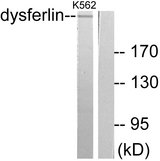 Dysferlin Antibody - Western blot analysis of lysates from K562 cells, using Dysferlin Antibody. The lane on the right is blocked with the synthesized peptide.