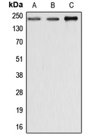 Dysferlin Antibody - Western blot analysis of Dysferlin expression in MCF7 (A); SP2/0 (B); rat liver (C) whole cell lysates.