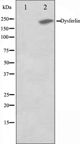 Dysferlin Antibody - Western blot analysis on K562 cell lysates using Dysferlin antibody. The lane on the left is treated with the antigen-specific peptide.