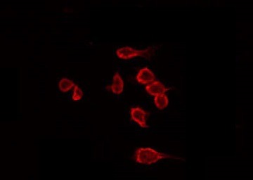 Dysferlin Antibody - Staining HeLa cells by IF/ICC. The samples were fixed with PFA and permeabilized in 0.1% Triton X-100, then blocked in 10% serum for 45 min at 25°C. The primary antibody was diluted at 1:200 and incubated with the sample for 1 hour at 37°C. An Alexa Fluor 594 conjugated goat anti-rabbit IgG (H+L) Ab, diluted at 1/600, was used as the secondary antibody.