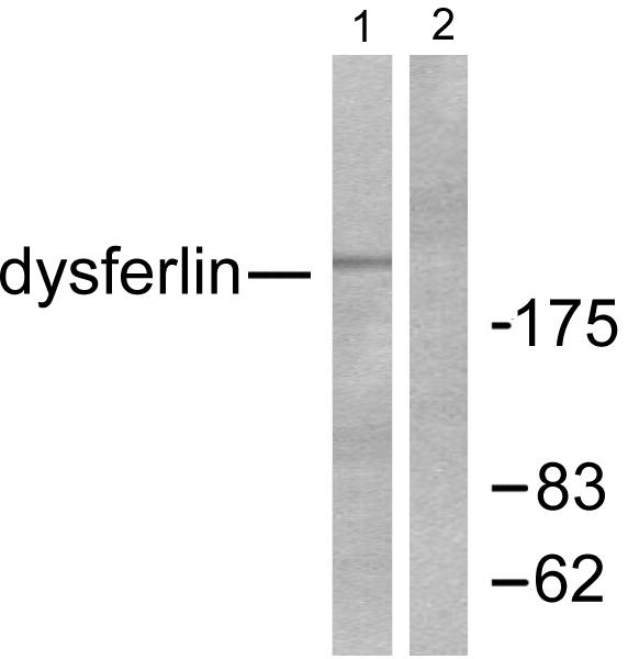 Dysferlin Antibody - Western blot analysis of extracts from K562 cells, using Dysferlin antibody.