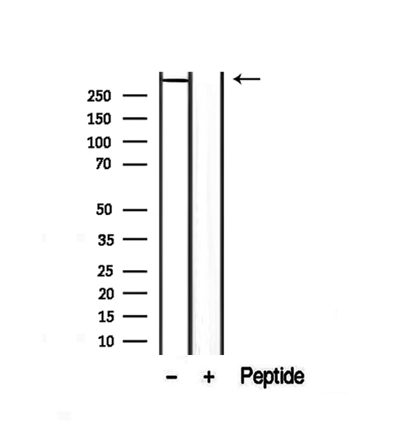 Dystonin / BPAG1 Antibody - Western blot analysis of extracts of A431 cells using DST antibody.