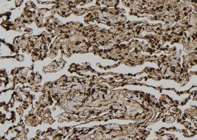 Dystonin / BPAG1 Antibody - 1:100 staining human lung tissue by IHC-P. The sample was formaldehyde fixed and a heat mediated antigen retrieval step in citrate buffer was performed. The sample was then blocked and incubated with the antibody for 1.5 hours at 22°C. An HRP conjugated goat anti-rabbit antibody was used as the secondary.