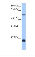 DYX1C1 Antibody - Hela cell lysate. Antibody concentration: 1.0 ug/ml. Gel concentration: 12%.  This image was taken for the unconjugated form of this product. Other forms have not been tested.