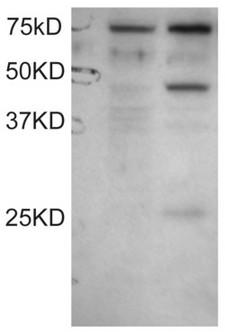 DYX1C1 Antibody - Antibody staining (0.1 ug/ml) of COS1 cell lysates: untransfected (left lane) and transfected with full length recombinant Human DYX1C1 (right lane). Data kindly provided by Wang and LoTurco, University of Connecticut, USA.