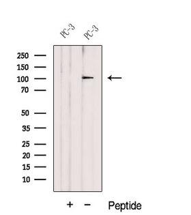 DZIP1 Antibody - Western blot analysis of extracts of PC-3 cells using DZIP1 antibody. The lane on the left was treated with blocking peptide.