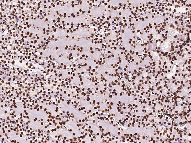 DZIP1 Antibody - Immunochemical staining of mouse DZIP1 in mouse kidney with rabbit polyclonal antibody at 1:1000 dilution, formalin-fixed paraffin embedded sections.