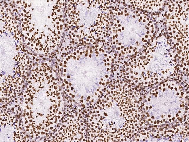 DZIP1 Antibody - Immunochemical staining of mouse DZIP1 in mouse testis with rabbit polyclonal antibody at 1:1000 dilution, formalin-fixed paraffin embedded sections.