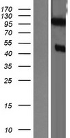 DZIP1 Protein - Western validation with an anti-DDK antibody * L: Control HEK293 lysate R: Over-expression lysate