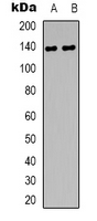 DZIP3 Antibody - Western blot analysis of DZIP3 expression in HEK293T (A); A431 (B) whole cell lysates.