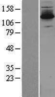 DZIP3 Protein - Western validation with an anti-DDK antibody * L: Control HEK293 lysate R: Over-expression lysate