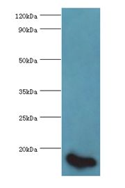 E-FABP / FABP5 Antibody - Western blot. All lanes: FABP5 antibody at 5 ug/ml+HepG2 whole cell lysate. Secondary antibody: Goat polyclonal to rabbit at 1:10000 dilution. Predicted band size : 15 kDa. Observed band size: 15 kDa.