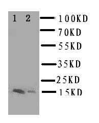 E-FABP / FABP5 Antibody - WB of E-FABP / FABP5 antibody. Lane 1: Rat Liver Tissue Lysate. Lane 2: Rat Kidney Tissue Lysate.