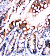 E-FABP / FABP5 Antibody - E-FABP / FABP5 antibody. IHC(P): Rat Intestine Tissue.