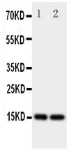 E-FABP / FABP5 Antibody - Anti-Fatty Acid Binding Protein 5 antibody, Western blotting All lanes: Anti Fatty Acid Binding Protein 5 at 0.5ug/ml Lane 1: Rat Liver Tissue Lysate at 50ug Lane 2: Rat Kidney Tissue Lysate at 50ug Predicted bind size: 15KD Observed bind size: 15KD