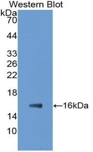 E-FABP / FABP5 Antibody - Western blot of recombinant E-FABP / FABP5.  This image was taken for the unconjugated form of this product. Other forms have not been tested.