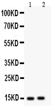 E-FABP / FABP5 Antibody - Western blot - Anti-Fatty Acid Binding Protein 5 Antibody