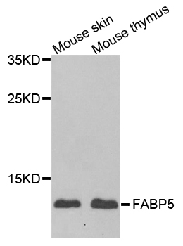 E-FABP / FABP5 Antibody - Western blot analysis of extracts of mouse testis.