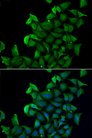 E-FABP / FABP5 Antibody - Immunofluorescence analysis of A549 cells.