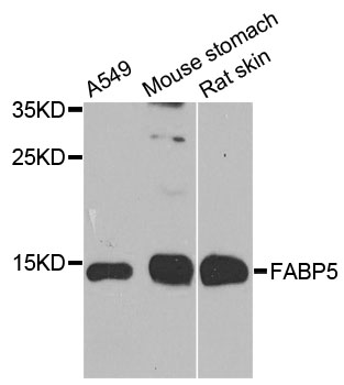 E-FABP / FABP5 Antibody - Western blot analysis of extracts of various cell lines, using FABP5 antibody at 1:1000 dilution. The secondary antibody used was an HRP Goat Anti-Rabbit IgG (H+L) at 1:10000 dilution. Lysates were loaded 25ug per lane and 3% nonfat dry milk in TBST was used for blocking. An ECL Kit was used for detection and the exposure time was 90s.
