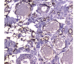 E-FABP / FABP5 Antibody - IHC analysis of FABP5 using anti-FABP5 antibody