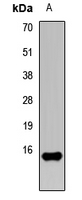 E-FABP / FABP5 Antibody