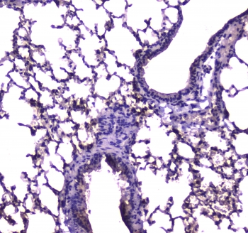 E-FABP / FABP5 Antibody - IHC testing of FFPE mouse lung tissue with FABP5 antibody at 1ug/ml. Required HIER: steam section in pH6 citrate buffer for 20 min and allow to cool prior to staining.