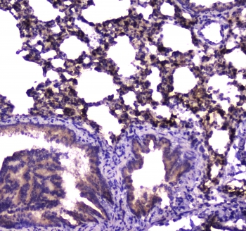 E-FABP / FABP5 Antibody - IHC testing of FFPE rat lung tissue with FABP5 antibody at 1ug/ml. Required HIER: steam section in pH6 citrate buffer for 20 min and allow to cool prior to staining.