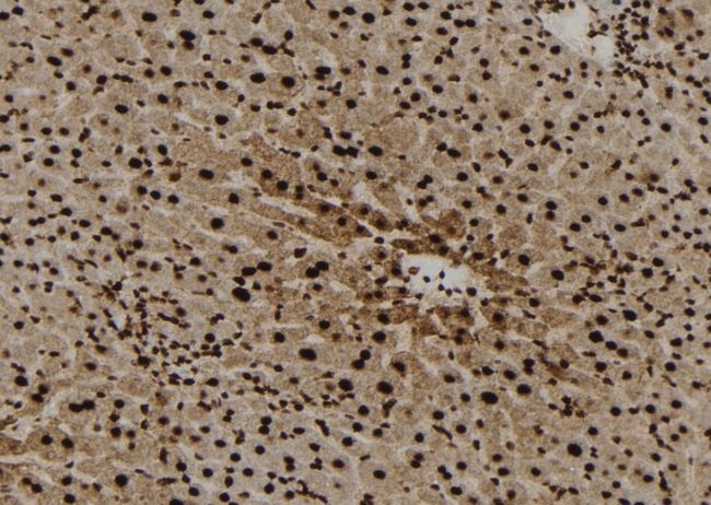 E-FABP / FABP5 Antibody - 1:100 staining mouse liver tissue by IHC-P. The sample was formaldehyde fixed and a heat mediated antigen retrieval step in citrate buffer was performed. The sample was then blocked and incubated with the antibody for 1.5 hours at 22°C. An HRP conjugated goat anti-rabbit antibody was used as the secondary.