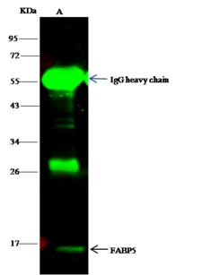 E-FABP / FABP5 Antibody - FABP5 was immunoprecipitated using: Lane A: 0.5 mg A431 Whole Cell Lysate. 4 uL anti-FABP5 rabbit polyclonal antibody and 15 ul of 50% Protein G agarose. Primary antibody: Anti-FABP5 rabbit polyclonal antibody, at 1:100 dilution. Secondary antibody: Dylight 800-labeled antibody to rabbit IgG (H+L), at 1:5000 dilution. Developed using the odssey technique. Performed under reducing conditions. Predicted band size: 15 kDa. Observed band size: 15 kDa.