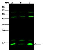 E-FABP / FABP5 Antibody - Anti-FABP5 rabbit polyclonal antibody at 1:500 dilution. Lane A: HeLa Whole Cell Lysate. Lane B: A431 Whole Cell Lysate. Lane C: HepG2 Whole Cell Lysate. Lysates/proteins at 30 ug per lane. Secondary: Goat Anti-Rabbit IgG H&L (Dylight 800) at 1/10000 dilution. Developed using the Odyssey technique. Performed under reducing conditions. Predicted band size: 15 kDa. Observed band size: 15 kDa. (We are unsure as to the identity of these extra bands.)