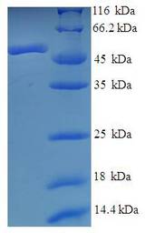 ADA / Adenosine Deaminase Protein