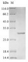 Beta-Lactamase CTX-M-1 Protein - (Tris-Glycine gel) Discontinuous SDS-PAGE (reduced) with 5% enrichment gel and 15% separation gel.