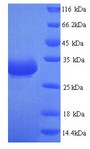 Beta-Lactamase CTX-M-1 Protein