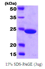 Carbonic Anhydrase Protein
