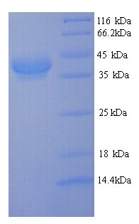 CFA/I Fimbrial Subunit E Protein