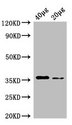 E. coli dcyD Antibody - Western Blot Positive WB detected in: Rosseta bacteria lysate at 40µg, 20µg All lanes: dcyD antibody at 0.25µg/ml Secondary Goat polyclonal to rabbit IgG at 1/50000 dilution Predicted band size: 36 kDa Observed band size: 36 kDa