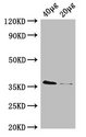 E. coli dcyD Antibody - Western Blot Positive WB detected in: Rosseta bacteria lysate at 40µg, 20µg All lanes: dcyD antibody at 0.42µg/ml Secondary Goat polyclonal to rabbit IgG at 1/10000 dilution Predicted band size: 36 kDa Observed band size: 36 kDa