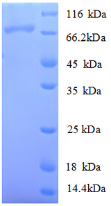 DNA Ligase Protein