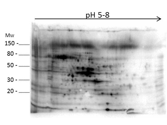 E. coli / Escherichia coli Antibody - 2D Western Blot of anti-E.coli Host Cell Protein antibody. Load: 35 ug Total HCP. Primary antibody: Rabbit anti-HCP antibody at 1:200 for overnight at 4 degrees C. Secondary antibody: Goat anti-rabbit secondary antibody at 1:10,000 for 30 min at RT. Block: MB-070 for 1 hour at RT. This image was taken for the unconjugated form of this product. Other forms have not been tested.