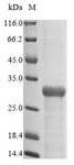 FimH Protein - (Tris-Glycine gel) Discontinuous SDS-PAGE (reduced) with 5% enrichment gel and 15% separation gel.