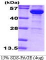 G6PD Protein