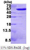 gor/Glutathione Oxidoreductase Protein