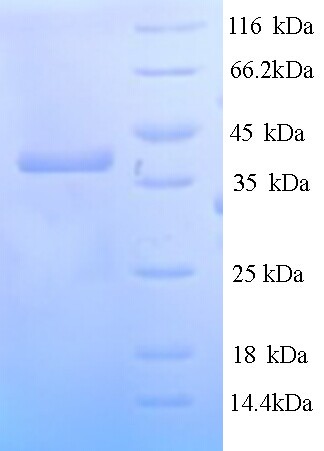 Hygromycin-B 4-O-kinase Protein